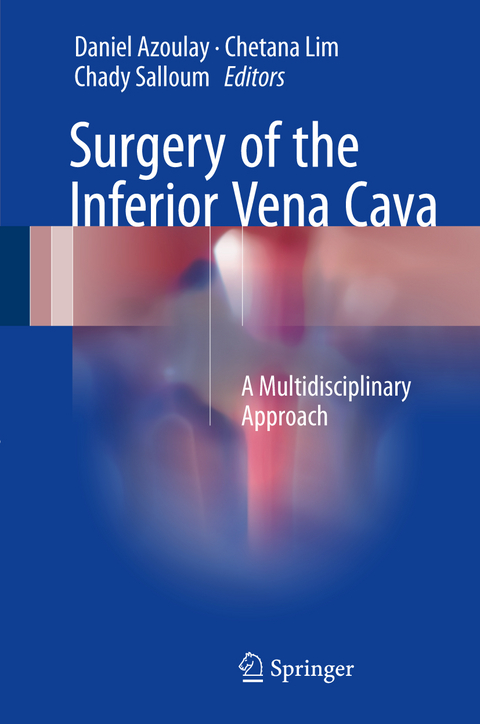 Surgery of the Inferior Vena Cava - 