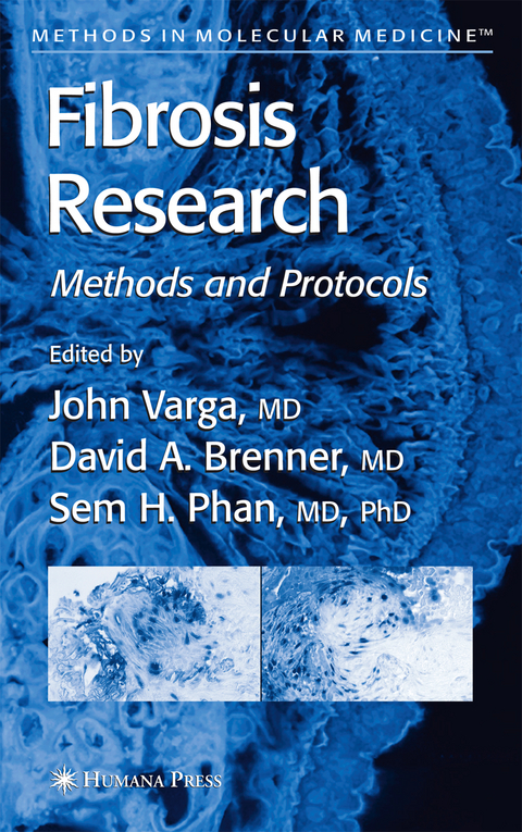 Fibrosis Research - 