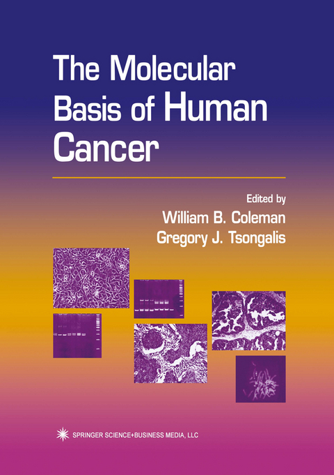 The Molecular Basis of Human Cancer - 