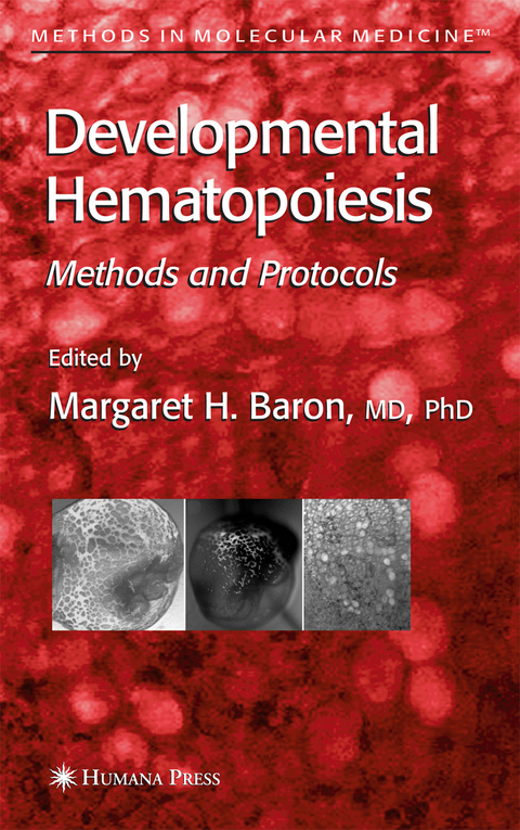 Developmental Hematopoiesis - 