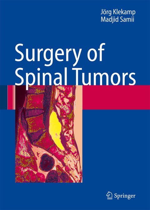 Surgery of Spinal Tumors - Jörg Klekamp, Madjid Samii