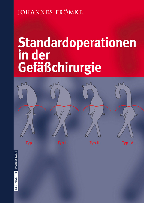 Standardoperationen in der Gefäßchirurgie - Johannes Frömke