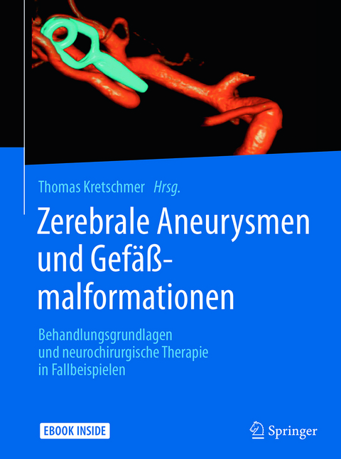 Zerebrale Aneurysmen und Gefäßmalformationen - 