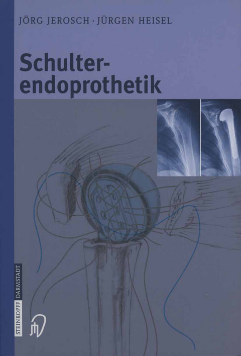 Schulterendoprothetik - Jörg Jerosch, Jürgen Heisel