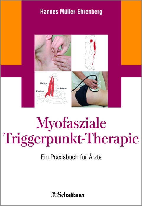Myofasziale Triggerpunkt-Therapie - Hannes Müller-Ehrenberg