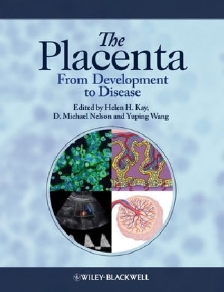 The Placenta - H Kay