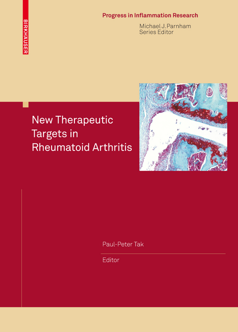 New Therapeutic Targets in Rheumatoid Arthritis - 