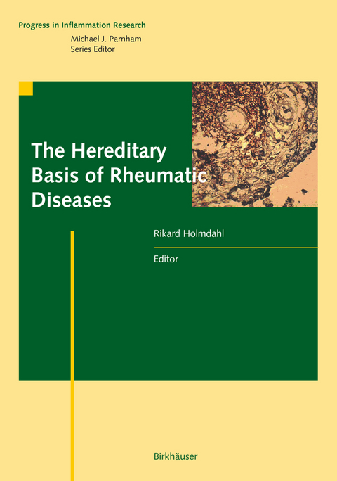 The Hereditary Basis of Rheumatic Diseases - 