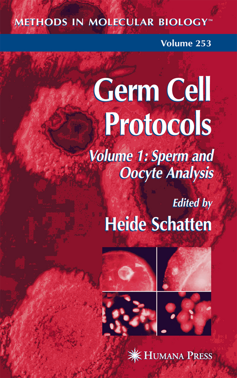 Germ Cell Protocols - 