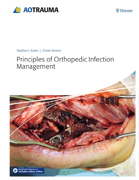 Principles of Orthopedic Infection Management - Stephen Kates, Olivier Borens