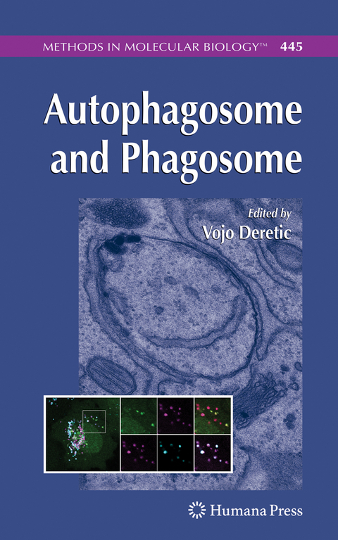 Autophagosome and Phagosome - 