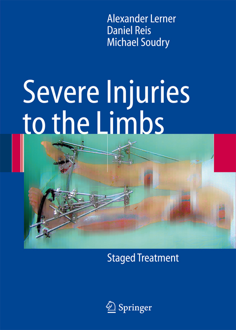 Severe Injuries to the Limbs - Alexander Lerner, Daniel Reis, Michael Soudry