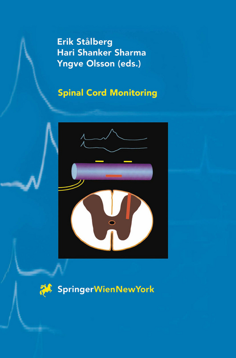 Spinal Cord Monitoring - 