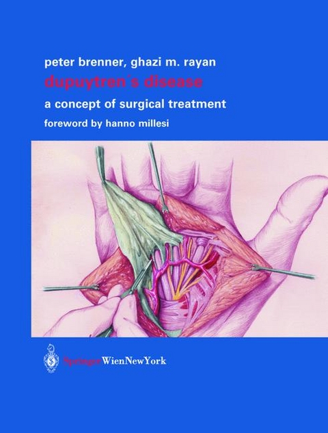 Dupuytren’s Disease - Peter Brenner, Ghazi M. Rayan