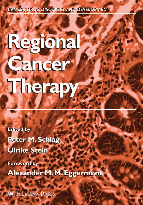 Regional Cancer Therapy - 