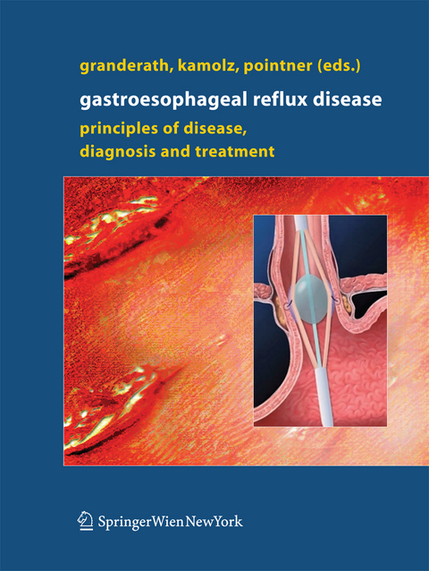 Gastroesophageal Reflux Disease - 