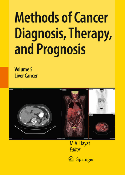 Methods of Cancer Diagnosis, Therapy, and Prognosis - 