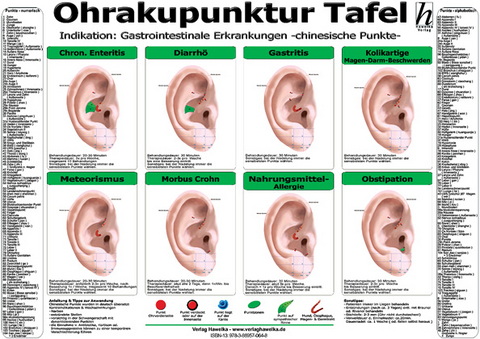 Ohrakupunktur Tafel - Indikation: Gastrointestinale Erkrangungen - 