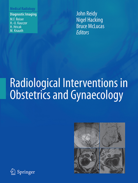 Radiological Interventions in Obstetrics and Gynaecology - 