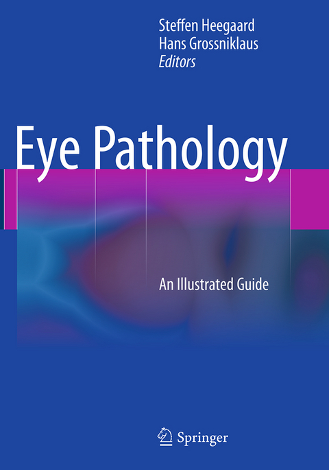 Eye Pathology - 