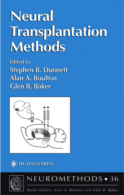 Neural Transplantation Methods - 