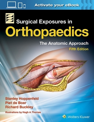 Surgical Exposures in Orthopaedics: the Anatomic Approach - Stanley Hoppenfeld, Piet de Boer, Richard Buckley