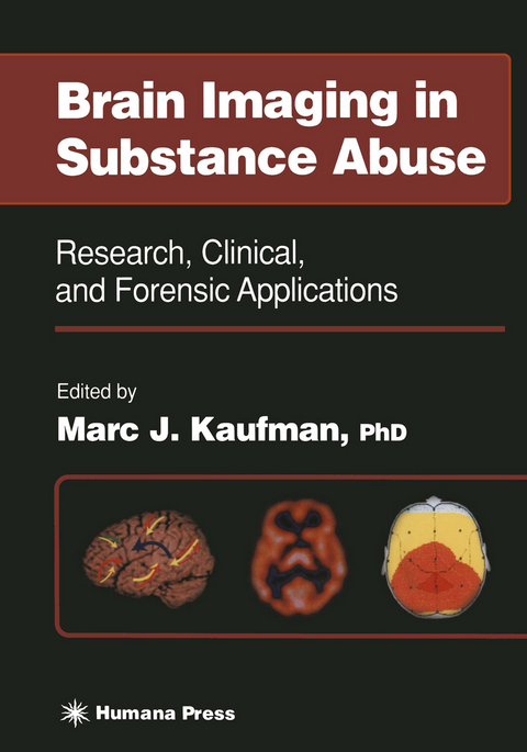 Brain Imaging in Substance Abuse - 
