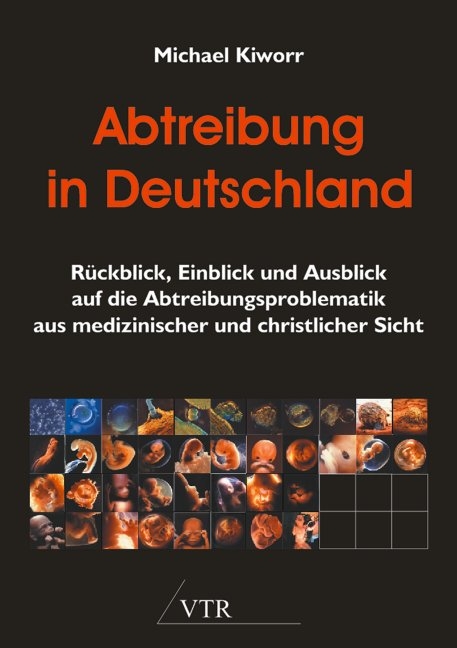 Abtreibung in Deutschland - Michael Kiworr