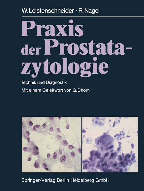 Praxis der Prostatazytologie - W. Leistenschneider, R. Nagel