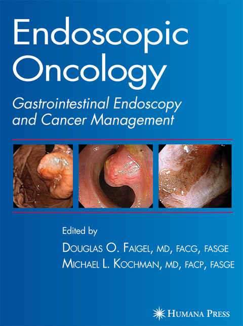 Endoscopic Oncology - 