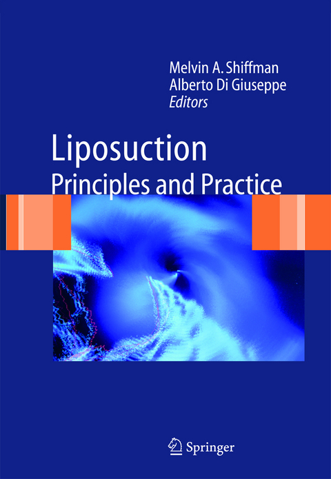 Liposuction - 