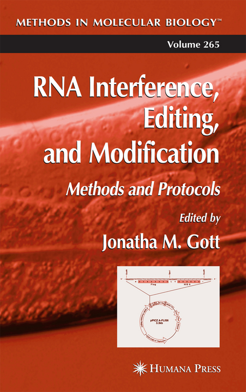 RNA Interference, Editing, and Modification - 