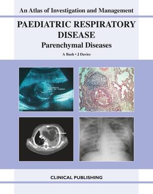 Paediatric Respiratory Disease - Parenchymal Diseases - 