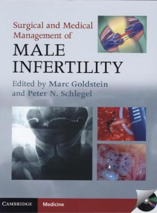 Surgical and Medical Management of Male Infertility - 