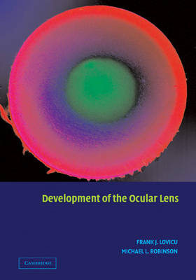 Development of the Ocular Lens - 