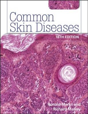 Common Skin Diseases 18th edition - Ronald Marks, Richard Motley