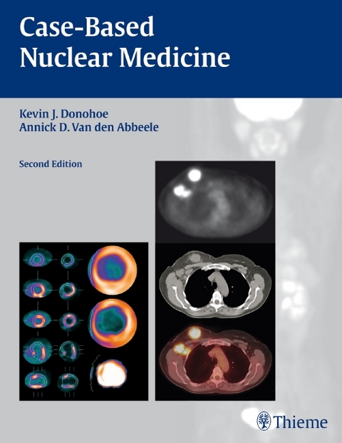 Case-Based Nuclear Medicine - 