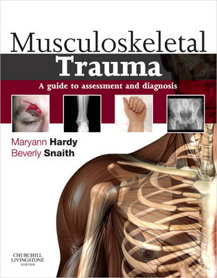 Musculoskeletal Trauma - 