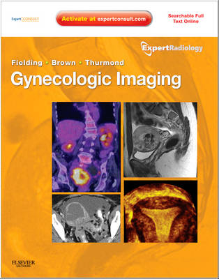 Gynecologic Imaging - Julia R. Fielding, Douglas L. Brown, Amy S. Thurmond