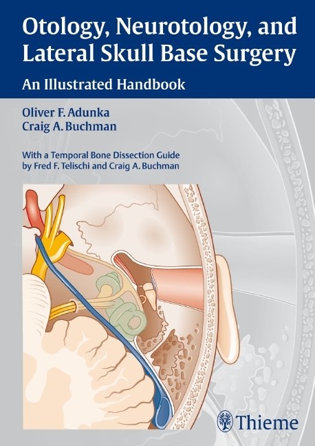 Otology, Neurotology, and Lateral Skull-Base Surgery: - Oliver Franz Adunka, Craig A. Buchman