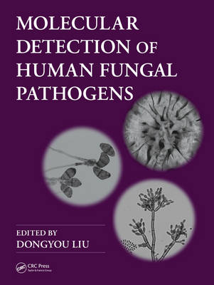 Molecular Detection of Human Fungal Pathogens - 