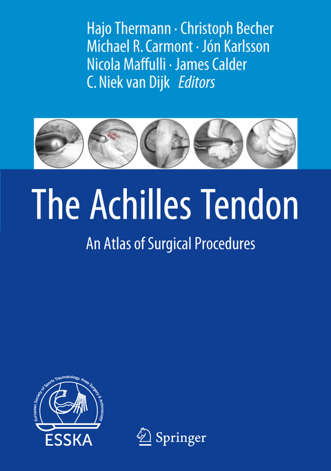The Achilles Tendon - 