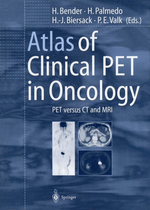 Atlas of Clinical PET in Oncology - 
