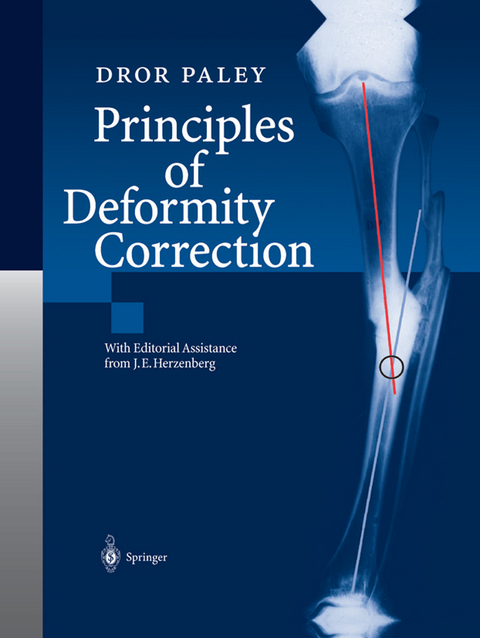 Principles of Deformity Correction - Dror Paley