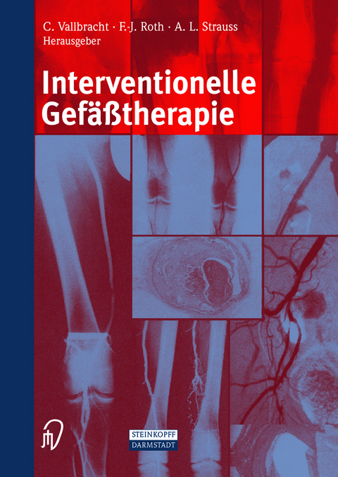 Interventionelle Gefäßtherapie - 