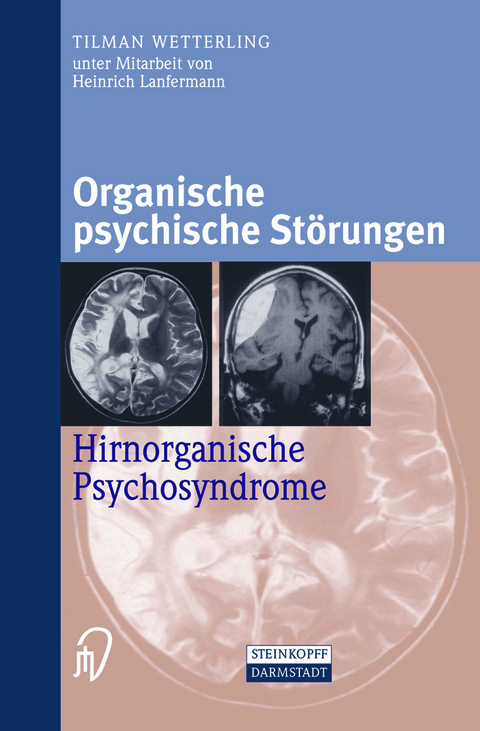 Organische psychische Störungen - Tilman Wetterling