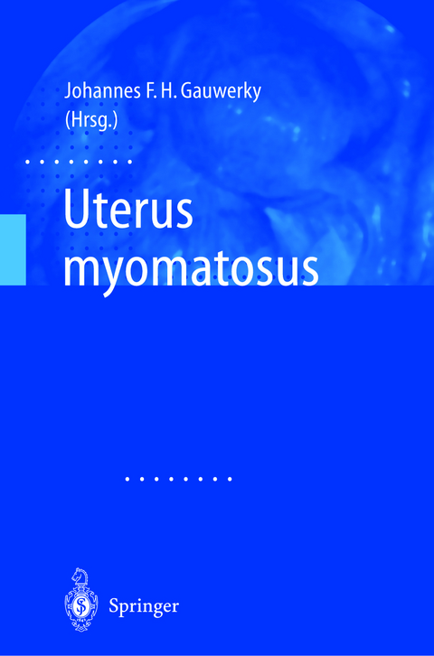 Uterus myomatosus - 