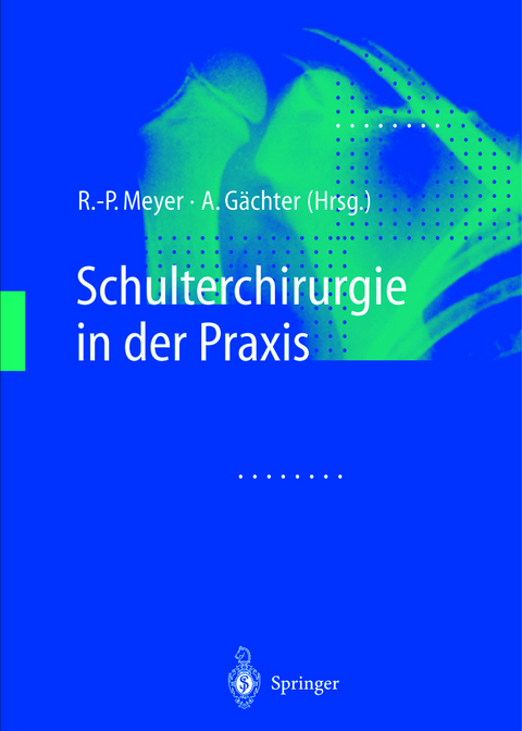 Schulterchirurgie in der Praxis - 