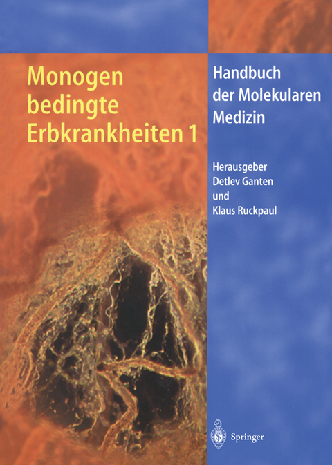 Monogen bedingte Erbkrankheiten 1 - 