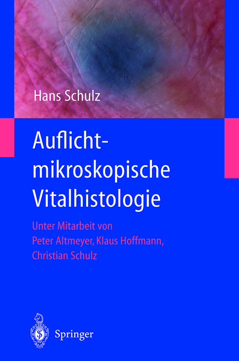 Auflichtmikroskopische Vitalhistologie - Hans Schulz